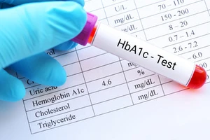 Blood sample HbA1c test diabetes diagnosis