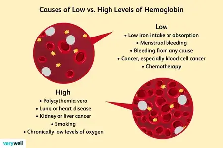 Hemoglobin level infographic