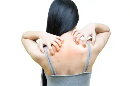 the-back-of-the-woman-itching-and-scratching