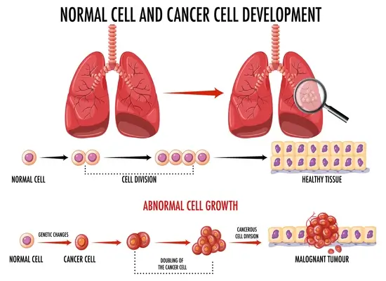 diagram-showing-normal-and-cancer-cell