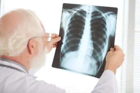 doctor-checking-x-ray-for-lung-cancer-treatments