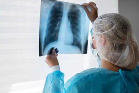 doctor-checks-chest-x-rays-to-diagnose-tuberculosis-tb