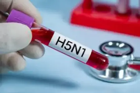 blood-sample-for-diagnosing-bird-flu-virus-h5n1