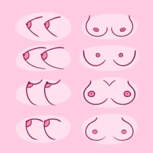 different-types-of-female-breast-shapes-collection